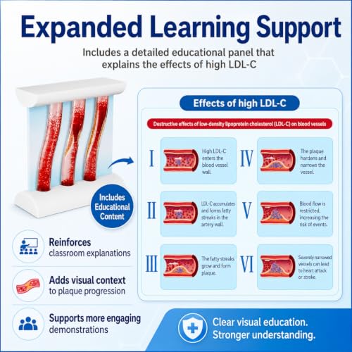 Atherosclerosis Artery Model, LDL Plaque Cardiovascular Teaching Aid