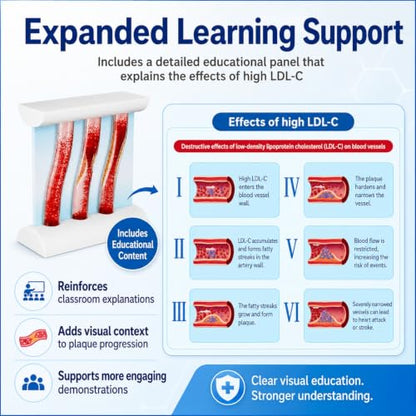 Atherosclerosis Artery Model, LDL Plaque Cardiovascular Teaching Aid