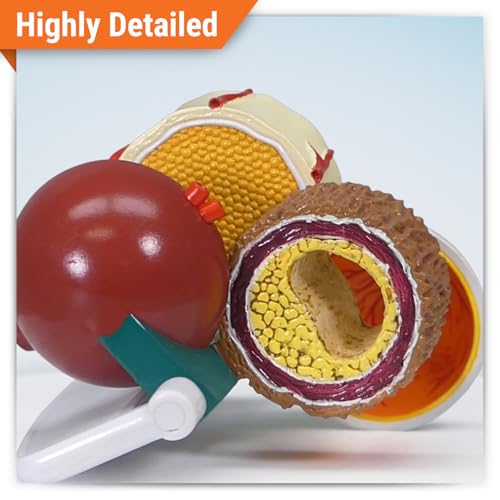 GPI Anatomicals 4-Piece Diabetes Model, Replica with Pathologies - style: Diabetes Model