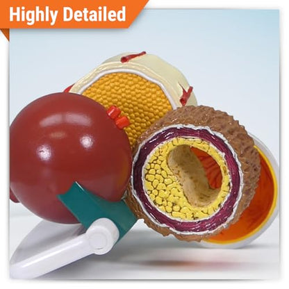GPI Anatomicals 4-Piece Diabetes Model, Replica with Pathologies - style: Diabetes Model