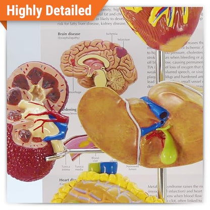 GPI Anatomicals Metabolic Syndrome Model Set - style: Metabolic Syndrome Model