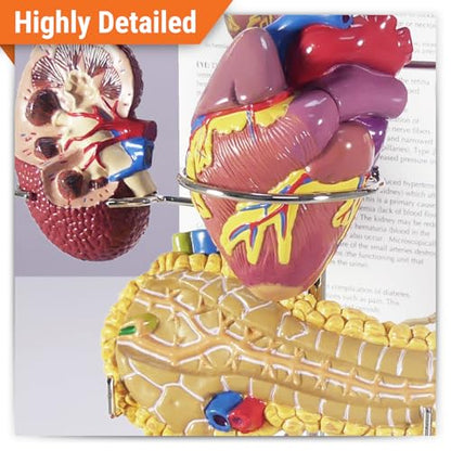 GPI Anatomicals Type II Diabetes Model Set - style: Type II Diabetes Model