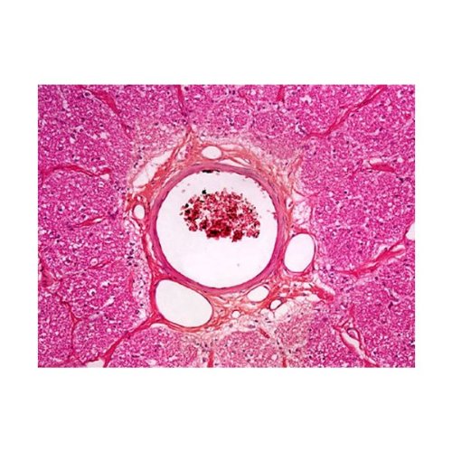 AmScope PS100A Prepared Microscope Slide Set, 100 Slides Set A - style: PS100A