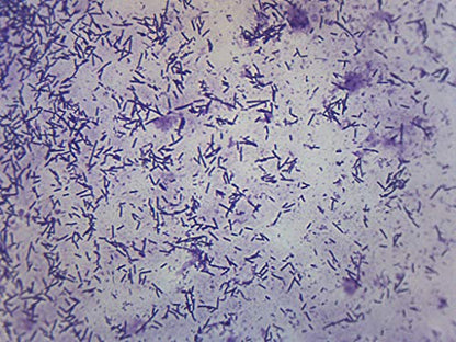 EISCO Escherichia Coli Smear, Gram Stain - Prepared Microscope Slide - 75 x 25mm - Biology & Microscopy - size: Single Slide