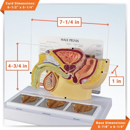 GPI Anatomicals Human Anatomy Model of Male Pelvis with 3D Prostate Frame - style: Male Pelvis with 3D Prostate Frame