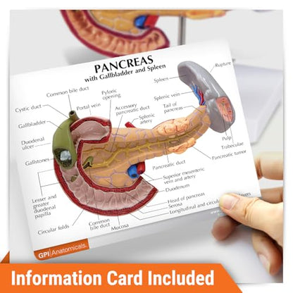 GPI Anatomicals Human Anatomy Model of Pancreas with Gallbladder and Spleen