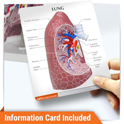 GPI Anatomicals Lung Model - style: Lung Model