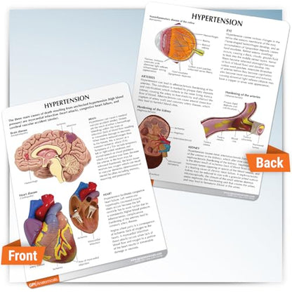 GPI Anatomicals Hypertension Model Set - style: Hypertension Model
