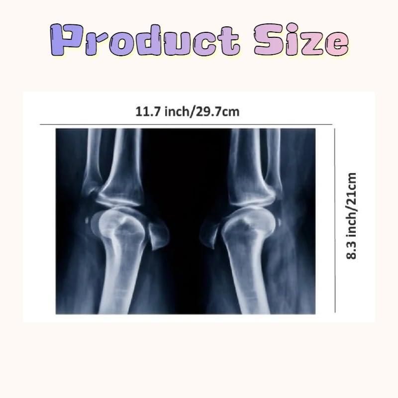 X-ray Science Education Package for Human Anatomy and Bone Parts is Suitable for Light Table and lamp Fittings.