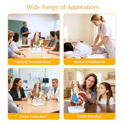 Lumbar Spine Model with Nerves, Female Pelvis Model Anatomy 1:1 Life Size Nerves Hip Joint Muscle Model Removable Movable Femur Heads Product Manual Card for Medical Education Study