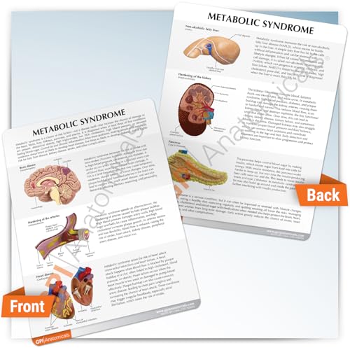 GPI Anatomicals Metabolic Syndrome Model Set - style: Metabolic Syndrome Model
