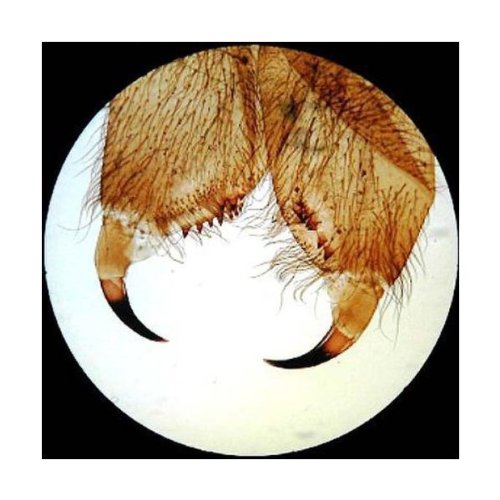 AmScope PS50A Prepared Microscope Slide Set, Biology & Pathology - style: Set