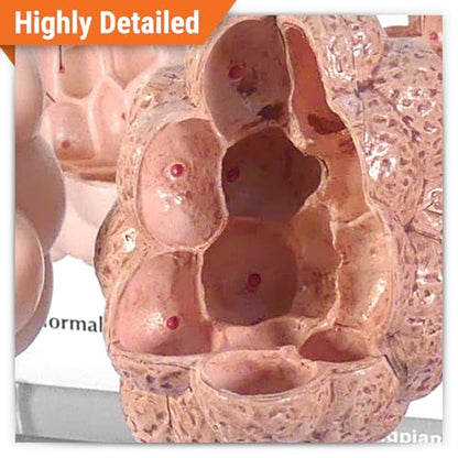 GPI Anatomicals Chronic Obstructive Pulmonary Disease (COPD) Model