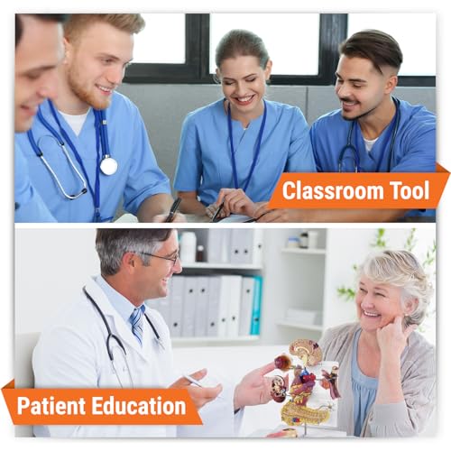 GPI Anatomicals Type II Diabetes Model Set - style: Type II Diabetes Model