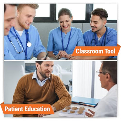 GPI Anatomicals Prostate Model Set, Replica with Pathologies - style: Prostate Model