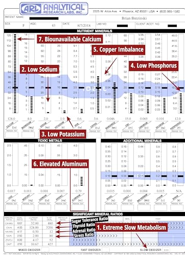 MineralBalance™ Hair Tissue Mineral Analysis (HTMA)—At-Home Test Kit for Fatigue, Anxiety, Sleep & Digestive Issues—Tests 21 Minerals & Heavy Metals Including Magnesium & Zinc—Full Lab Report Included