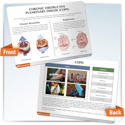GPI Anatomicals Chronic Obstructive Pulmonary Disease (COPD) Model
