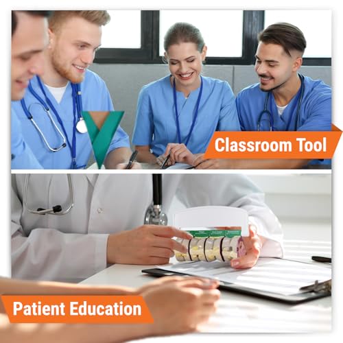 GPI Anatomicals 4-Piece Colon Model, Replica with Pathologies - style: Colon Model