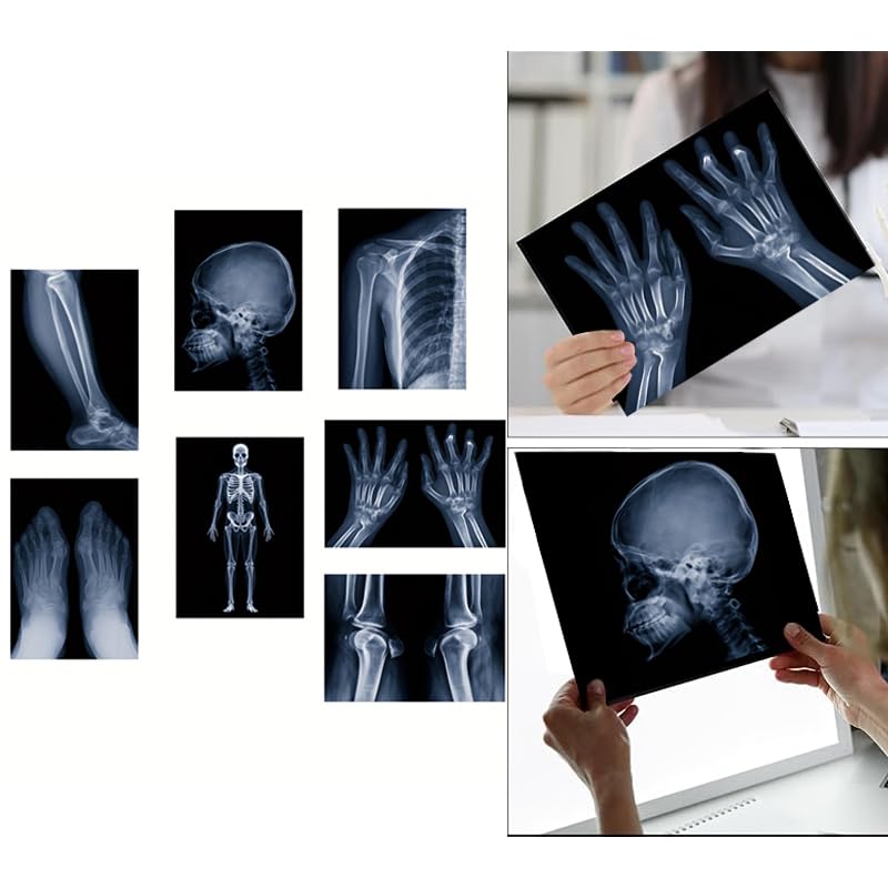 X-ray Science Education Package for Human Anatomy and Bone Parts is Suitable for Light Table and lamp Fittings.