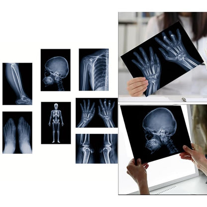 X-ray Science Education Package for Human Anatomy and Bone Parts is Suitable for Light Table and lamp Fittings.