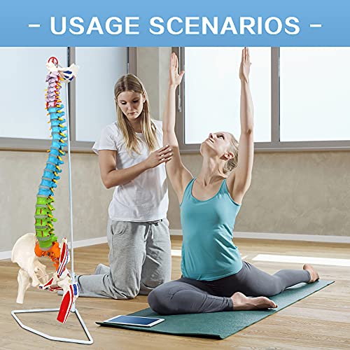 NEW HORIZON Scientific 34" Life Size Spinal Cord Model With Vertebrae, Nerves, Arteries, Lumbar Column, and Male Pelvis - Includes Stand (Good After-Sales)