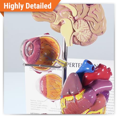 GPI Anatomicals Hypertension Model Set - style: Hypertension Model