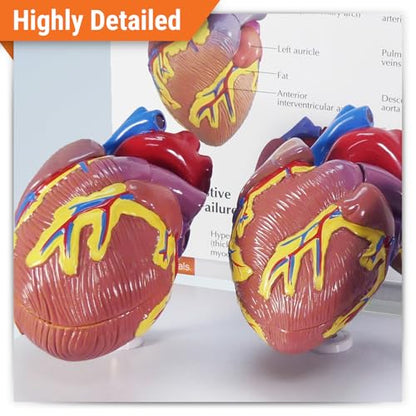 GPI Anatomicals 3-Piece Mini Heart Model Set, Normal and Diseased - style: Mini-Heart Model