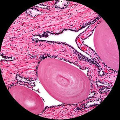 AmScope M150C-E5 1000X LED Microscope + 5MP USB Camera () - style: w/ 5.0MP Eyepiece Camera